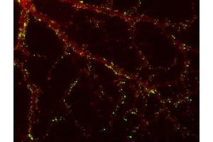 Indirect immunolabeling of PFA fixed rat hippocampus neurons with anti-SAP 102 (dilution 1 : 500; red) and mouse anti-synapsin 1 (cat. (DLG3 antibody)