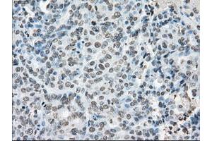 Image no. 2 for anti-P450 (Cytochrome) Oxidoreductase (POR) antibody (ABIN1497746) (POR antibody)