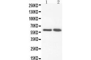Anti-FMO3 antibody, Western blotting Lane 1: Rat Liver Tissue Lysate Lane 2: Rat Liver Tissue Lysate (FMO3 antibody  (N-Term))