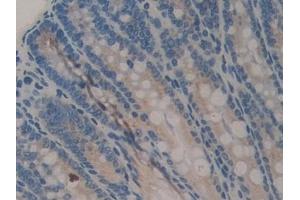 Detection of COMP in Mouse Colon Tissue using Polyclonal Antibody to Cartilage Oligomeric Matrix Protein (COMP) (COMP antibody  (AA 554-753))