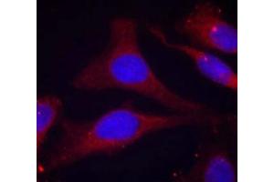 Immunofluorescence staining of methanol-fixed Hela cells using SHP-1(Phospho-Tyr536) Antibody. (SHP1 antibody  (pTyr536))