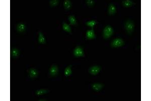 Immunofluorescence staining of A549 cells with ABIN7155365 at 1:133, counter-stained with DAPI. (HIST1H2AC antibody  (AA 2-130))
