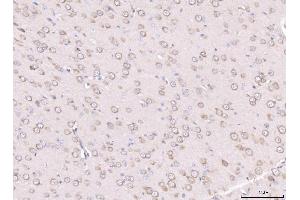IHC analysis of RPL29 using anti-RPL29 antibody (ABIN7600993). (RPL29 antibody  (AA 27-153))