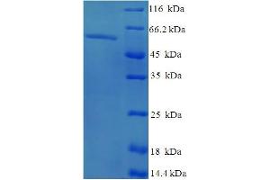 SDS-PAGE (SDS) image for Exonuclease 5 (EXO5) (AA 1-373), (full length) protein (His-SUMO Tag) (ABIN4975745)