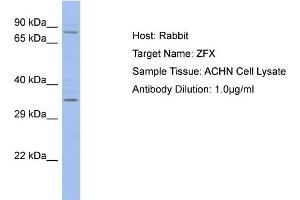Host: Rabbit Target Name: ZFX Sample Type: ACHN Whole cell lysates Antibody Dilution: 1. (ZFX antibody  (C-Term))