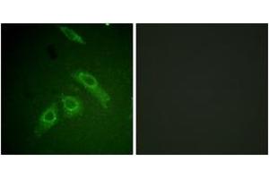 Immunofluorescence analysis of HepG2 cells, using FAK (Phospho-Ser910) Antibody. (FAK antibody  (pSer910))