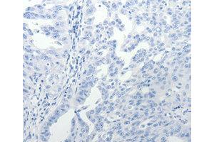 Immunohistochemistry (IHC) image for anti-USO1 Homolog, Vesicle Docking Protein (USO1) antibody (ABIN1875291) (USO1 antibody)