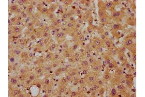 IHC image of ABIN7149649 diluted at 1:700 and staining in paraffin-embedded human liver tissue performed on a Leica BondTM system. (DLL3 antibody  (AA 27-492))