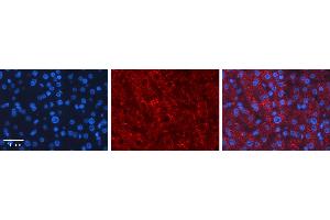 Immunohistochemistry (IHC) image for anti-Lecithin-Cholesterol Acyltransferase (LCAT) (C-Term) antibody (ABIN2776942) (LCAT antibody  (C-Term))
