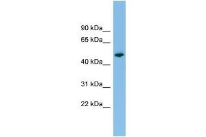 WB Suggested Anti-PTPRR Antibody Titration: 0. (PTPRR antibody  (N-Term))