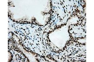 Image no. 3 for anti-Aryl Hydrocarbon Receptor Nuclear Translocator (ARNT) antibody (ABIN1496729) (ARNT antibody)