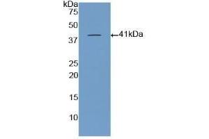 Detection of Recombinant BNP, Porcine using Polyclonal Antibody to Brain Natriuretic Peptide (BNP) (BNP antibody  (AA 26-131))