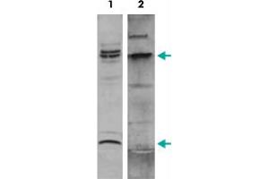 Western Blot (Cell lysate) analysis of nuclear extracts of ME-1 cells. (MYH11 antibody  (C-Term))