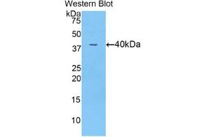 Western blot analysis of the recombinant protein. (Angiopoietin 4 antibody  (AA 32-144))