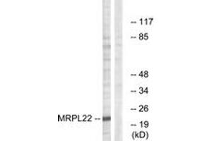 Western Blotting (WB) image for anti-Mitochondrial Ribosomal Protein L22 (MRPL22) (AA 91-140) antibody (ABIN2890053) (MRPL22 antibody  (AA 91-140))