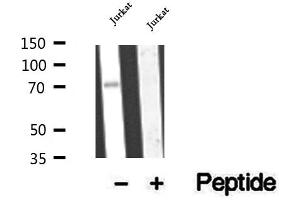 Western blot analysis of extracts of Jurkat cells, using CCDC93 antibody. (CCDC93 antibody  (C-Term))