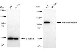 Western blotting analysis using ATP citrate lyase antibody (ABIN7797679).