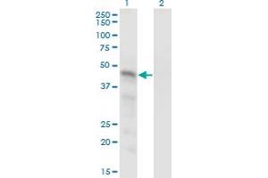 Western Blot analysis of SNX15 expression in transfected 293T cell line by SNX15 monoclonal antibody (M01), clone 1D4. (SNX15 antibody  (AA 51-139))