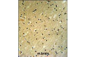BCOR Antibody (Center S1122) IHC analysis in formalin fixed and paraffin embedded mouse brain tissue followed by peroxidase conjugation of the secondary antibody and DAB staining. (BCMO1 antibody  (AA 1107-1137))