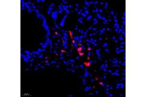 Immunofluorescence of paraffin embedded mouse lung using BIRC3 (ABIN7073179) at dilution of 1: 1000 (400x lens) (BIRC3 antibody)
