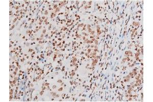 Immunohistochemistry (IHC) image for anti-Nuclear Factor-kB p65 (NFkBP65) (pThr435) antibody (ABIN6255688)