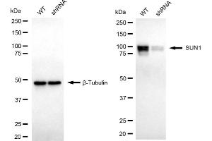 Western blotting analysis using SUN1 antibody (ABIN7800268). (Recombinant SUN1 antibody)
