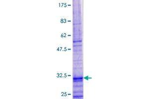 SDS-PAGE (SDS) image for Thymic Stromal Lymphopoietin (TSLP) (AA 1-60) protein (GST tag) (ABIN1800132) (Thymic Stromal Lymphopoietin Protein (TSLP) (AA 1-60) (GST tag))