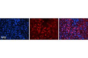 Rabbit Anti-FOS Antibody  AV Formalin Fixed Paraffin Embedded Tissue: Human Liver Tissue Observed Staining: Nucleus in hepatocytes Primary Antibody Concentration: 1:100 Other Working Concentrations: 1:600 Secondary Antibody: Donkey anti-Rabbit-Cy3 Secondary Antibody Concentration: 1:200 Magnification: 20X Exposure Time: 0.