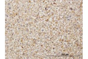 Image no. 1 for anti-Stromal Cell Derived Factor 2 (SDF2) (AA 1-212) antibody (ABIN598919) (SDF2 antibody  (AA 1-212))