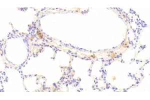 Detection of IFNb in Rat Lung Tissue using Monoclonal Antibody to Interferon Beta (IFNb) (IFNB1 antibody  (AA 23-169))