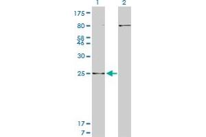Western Blot analysis of HOXB7 expression in transfected 293T cell line by HOXB7 monoclonal antibody (M04), clone 5B2. (HOXB7 antibody  (AA 55-120))