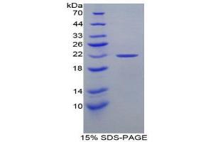 SDS-PAGE (SDS) image for Glucokinase (Hexokinase 4) Regulator (GCKR) (AA 320-499) protein (His tag) (ABIN1980930) (GCKR Protein (AA 320-499) (His tag))