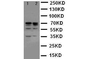 Anti-Lamin A+C antibody, Western blotting Lane 1: HELA Cell Lysate Lane 2: A431 Cell Lysate (Lamin A/C antibody  (C-Term))