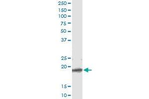 Immunoprecipitation of TCEAL1 transfected lysate using anti-TCEAL1 monoclonal antibody and Protein A Magnetic Bead , and immunoblotted with TCEAL1 MaxPab rabbit polyclonal antibody. (TCEAL1 antibody  (AA 1-159))