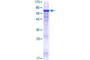 VMP1 Protein (AA 1-406) (GST tag)