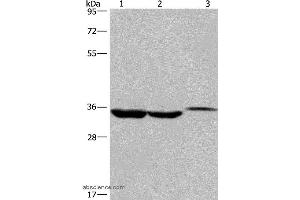 Western blot analysis of Lovo cell,human liver cancer tissue and mouse kidney tissue, using ING2 Polyclonal Antibody at dilution of 1:425 (ING2 antibody)