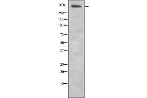 Western blot analysis of LAMA5 expression in HEK293 cells ,The lane on the left is treated with the antigen-specific peptide.