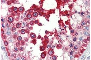 Human Testis: Formalin-Fixed, Paraffin-Embedded (FFPE)