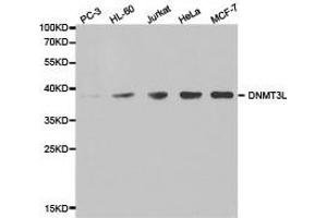 Western Blotting (WB) image for anti-DNA (Cytosine-5-)-Methyltransferase 3 Like (TRDMT1) antibody (ABIN1872332) (DNMT3L antibody)