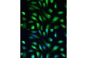 anti-Galectin 3 (LGALS3) (AA 1-250) antibody