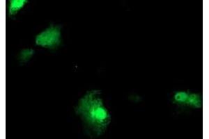 Anti-FBXO21 mouse monoclonal antibody (ABIN2455306) immunofluorescent staining of COS7 cells transiently transfected by pCMV6-ENTRY FBXO21 (RC223095). (FBXO21 antibody)