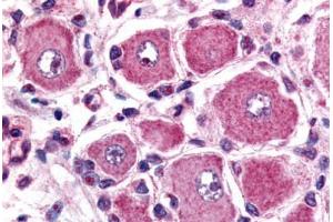Human Spinal Cord, Dorsal Root Ganglion (formalin-fixed, paraffin-embedded) stained with GPR149 antibody ABIN213496 at 2. (GPR149 antibody  (C-Term))