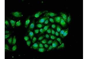 Immunofluorescence staining of A549 cells with ABIN7167205 at 1:66, counter-stained with DAPI. (RRAGA antibody  (AA 1-247))