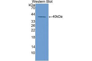 Figure. (KRT20 antibody  (AA 75-382))