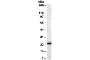 Western blot testing of human kidney lysate with GSTP1 antibody at 0. (GSTP1 antibody)