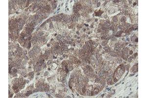 Image no. 1 for anti-OTU Domain, Ubiquitin Aldehyde Binding 1 (OTUB1) antibody (ABIN1499930) (OTUB1 antibody)