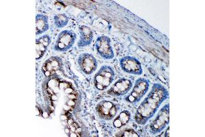 Anti-SSR3 antibody, IHC(P) IHC(P): Rat Intestine Tissue (SSR3 antibody  (N-Term))