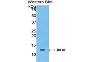 Detection of Recombinant PIGR, Bovine using Polyclonal Antibody to Polymeric Immunoglobulin Receptor (PIGR) (PIGR antibody  (AA 461-560))