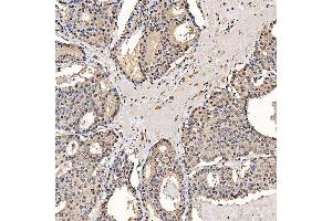 IHC analysis of SART1 using anti-SART1 antibody (ABIN7599884). (SART1 antibody  (AA 125-800))