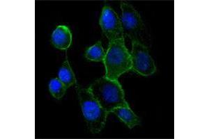 Immunofluorescence analysis of A431 cells using CDH2 mouse mAb (green). (N-Cadherin antibody)